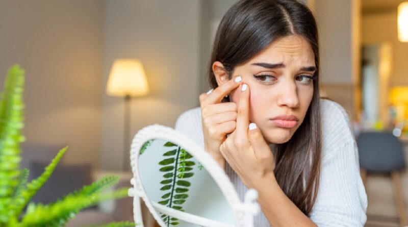 Peróxido de benzoíla para acne: benefícios e como usar