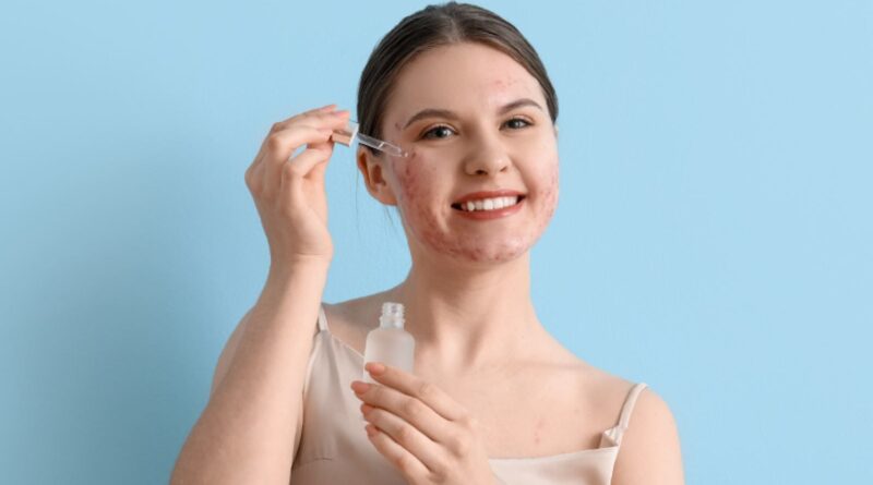 Ácido hialurônico para acne: saiba como ajuda