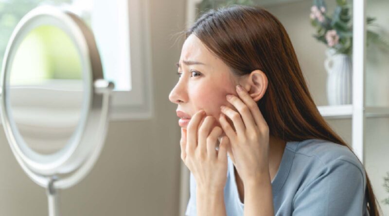 Rosacea gatilhos: Saiba o que piora os sintomas