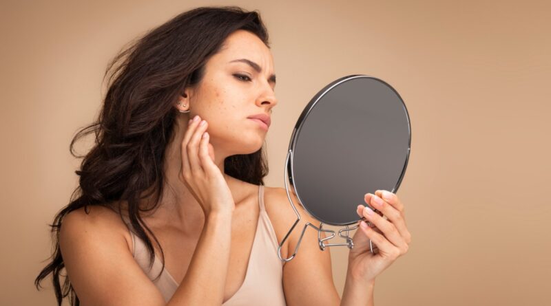Dieta hormonal de acne: os melhores e piores alimentos para acne