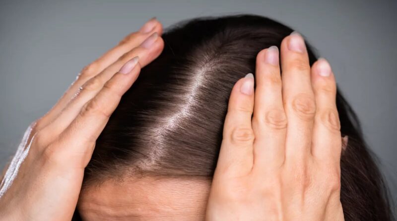 7 razões para cair de cabelo durante a temporada festiva e dicas para evitá -lo