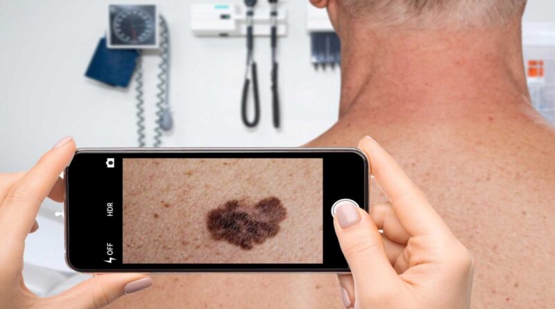 Você deve evitar aplicativos de pele de IA? Um dermatologista responde