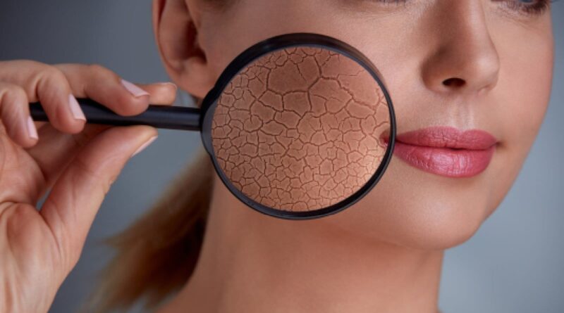 Dicas de cuidados com a pele no inverno: Dermat diz para evitar longos banhos quentes, aplicar cremes mais ricos